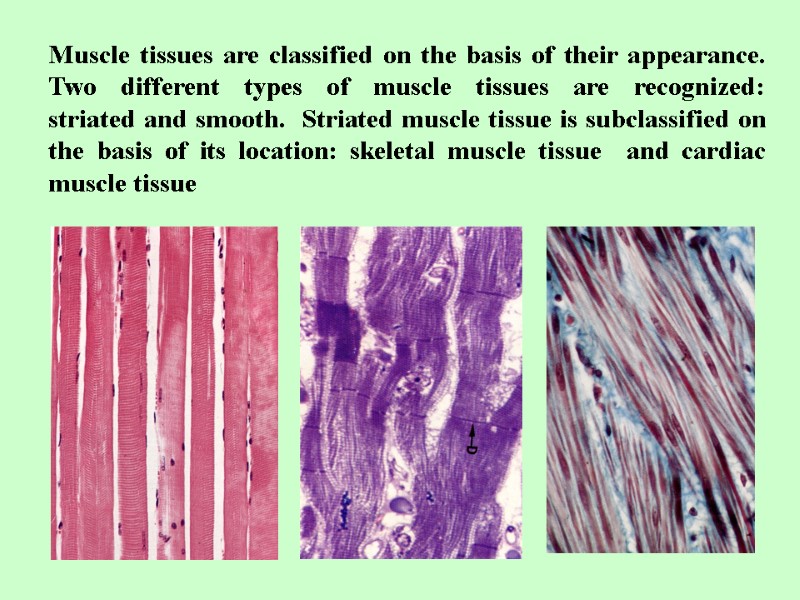 Muscle tissues are classified on the basis of their appearance. Two different types of